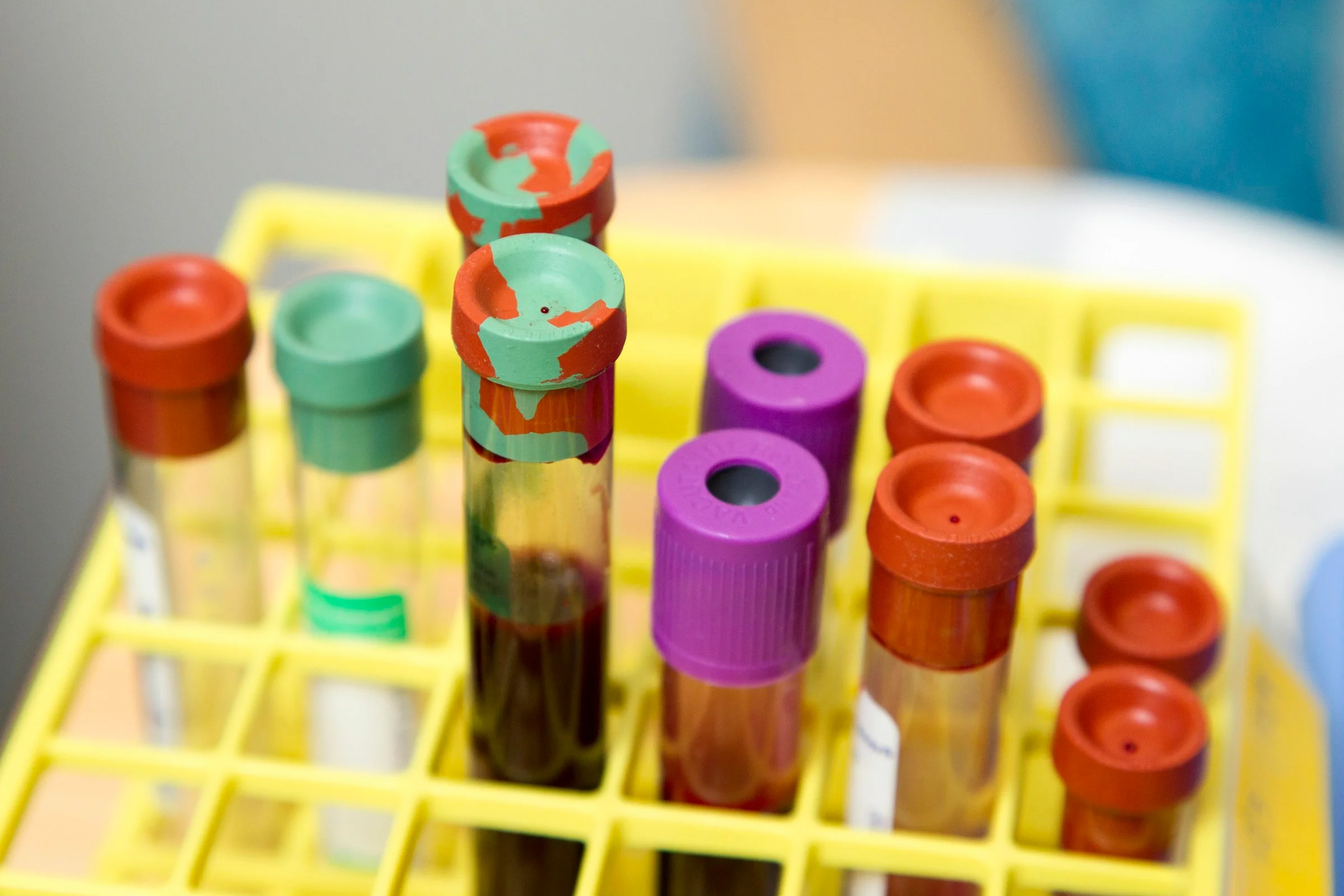 Blood collection tubes photographed by Daniel Sone